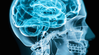 Nootropics for Lucid Dream Induction